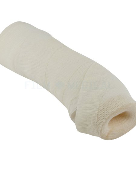 New Arm Cast